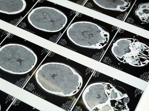 8 lead glass and face shields for eye radiation protection.jpg