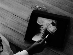 6 X-ray protection style options.jpg