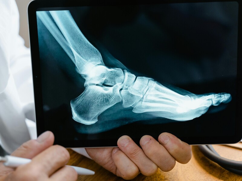 Mobile Shield vs. Fixed Shield: Choosing the Best Radiation Protection for Your Clinic