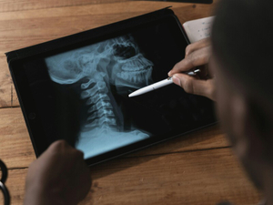 5 lead aprons for hospital radiation shielding.jpg