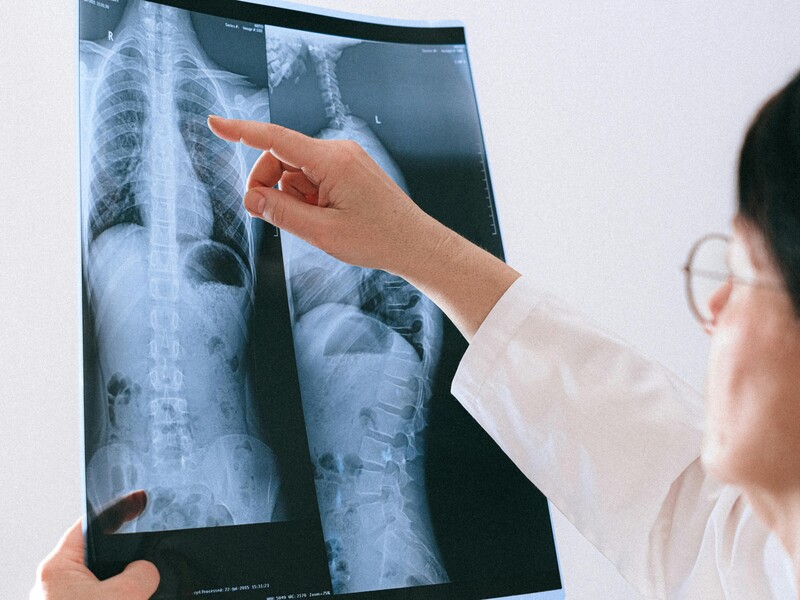 Why Protective Masks Are Used in Interventional Imaging